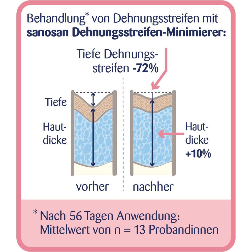 Sanosan Dehnungsstreifen Minimierer, 75 ml – Effektive Pflege nach der Schwangerschaft